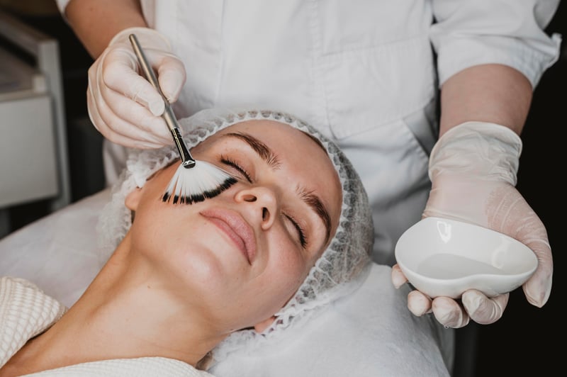 Peeling Químico — Tratamiento 2
